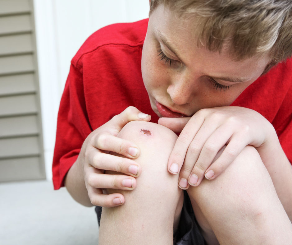 Kid examines fresh bruise on knee